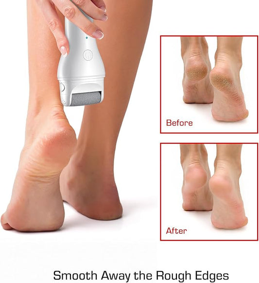 RED Cordless Foot Callus Remover