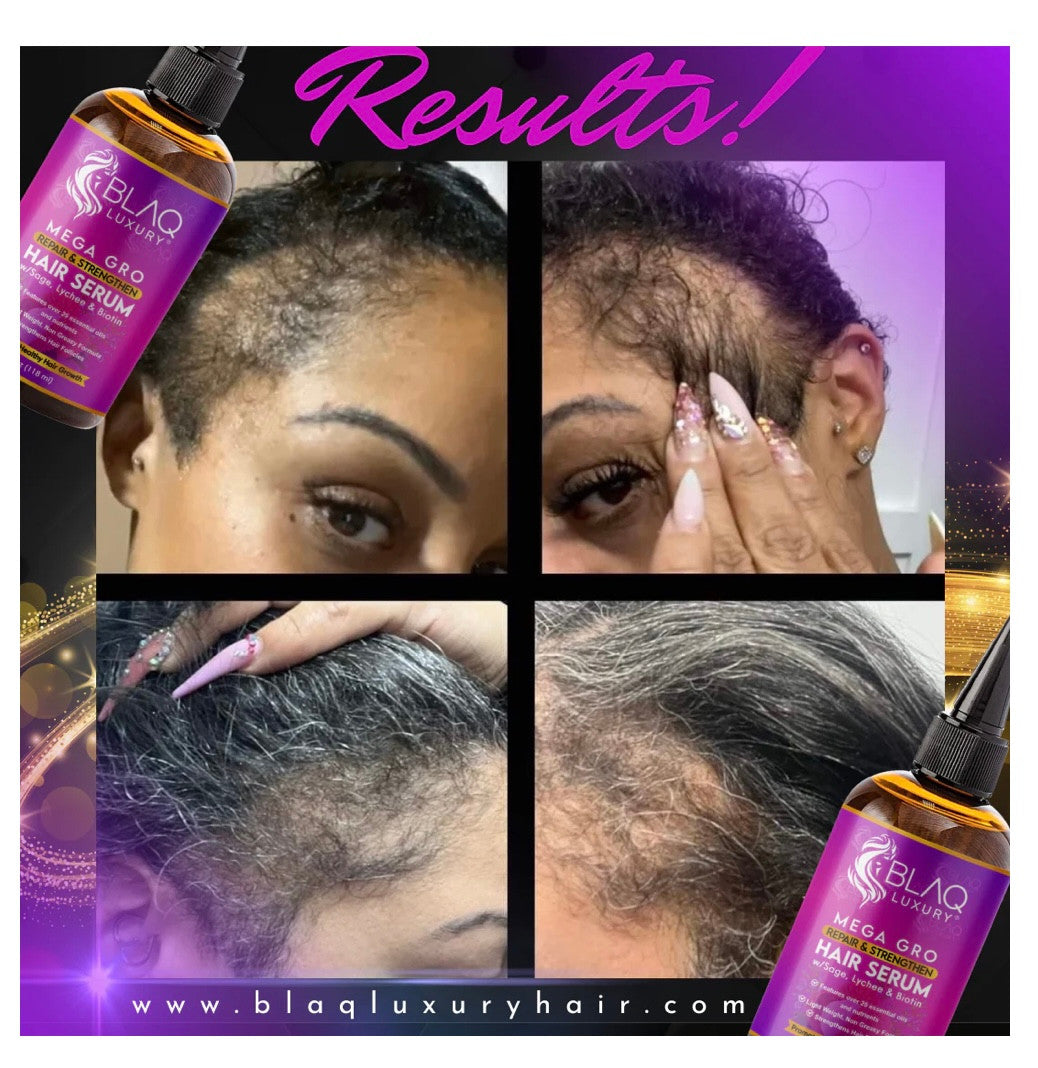 BLAQ Sage & Lychee Mega Gro Repair and Strengthen Hair Serum