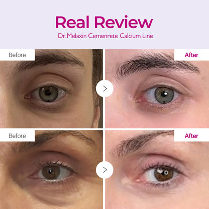 DR. MELAXIN Cemenrete Calcium Intense Cream (1.69oz)