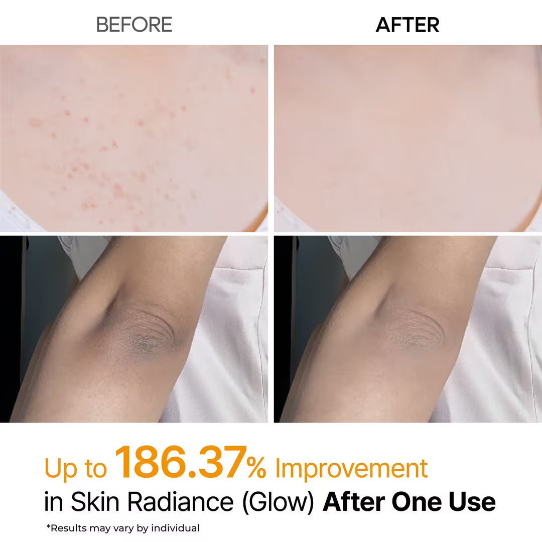 Dr.Melaxin Peel Shot Kojic Acid Turmeric Spray (6.76oz)