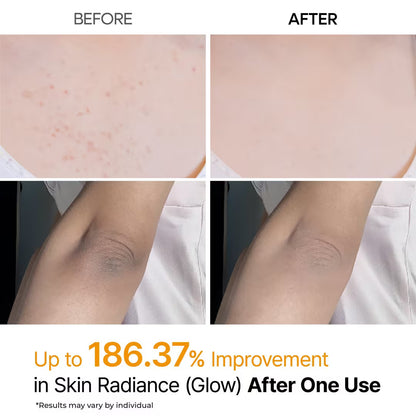 Dr.Melaxin Peel Shot Kojic Acid Turmeric Spray (6.76oz)