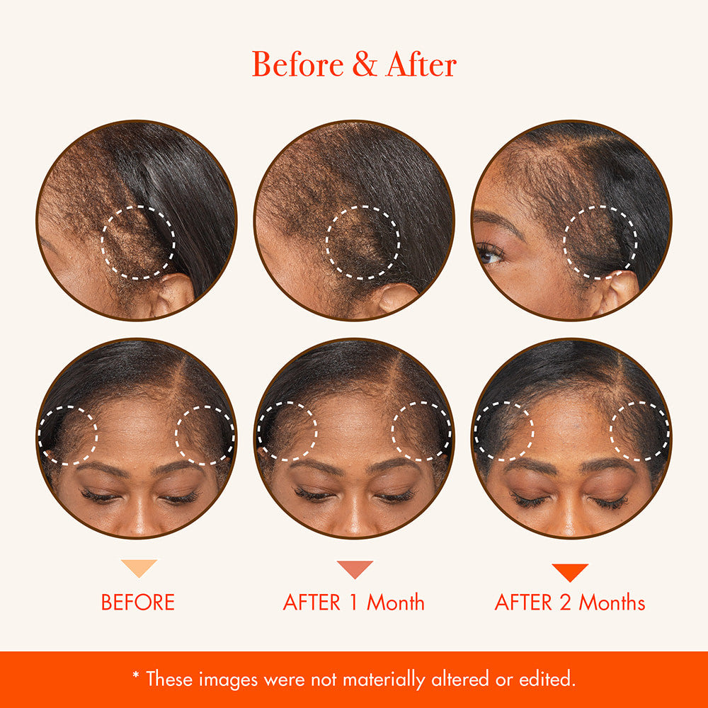 RED Growth MD Scalp Ampoule