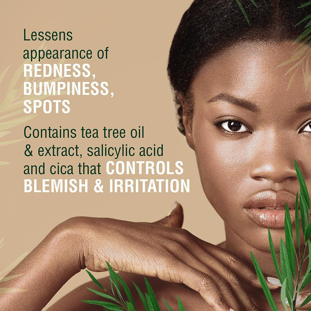 KISS Tea Tree Acne Treatment (0.94 oz)