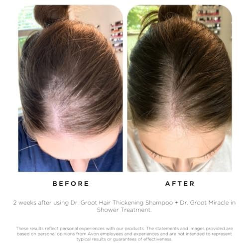 DR.GROOT Scalp Revitalizing Solution Hair Thickening Shampoo (13oz)