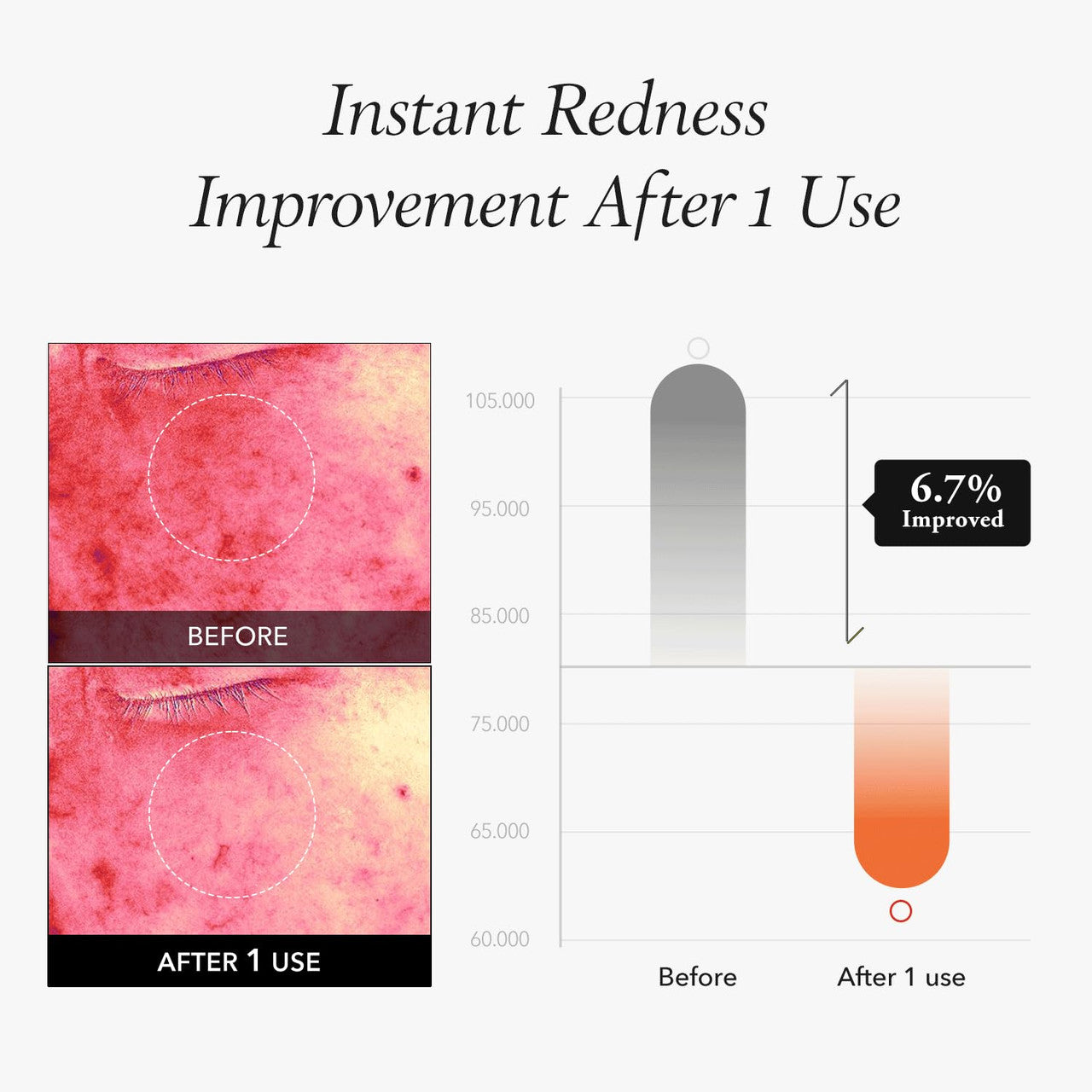 APRILSKIN Carrotene IPMP™ Instant Calming Serum Pads (80 Pads)