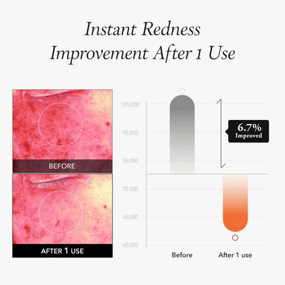 APRILSKIN Carrotene IPMP™ Instant Calming Serum Pads (80 Pads)