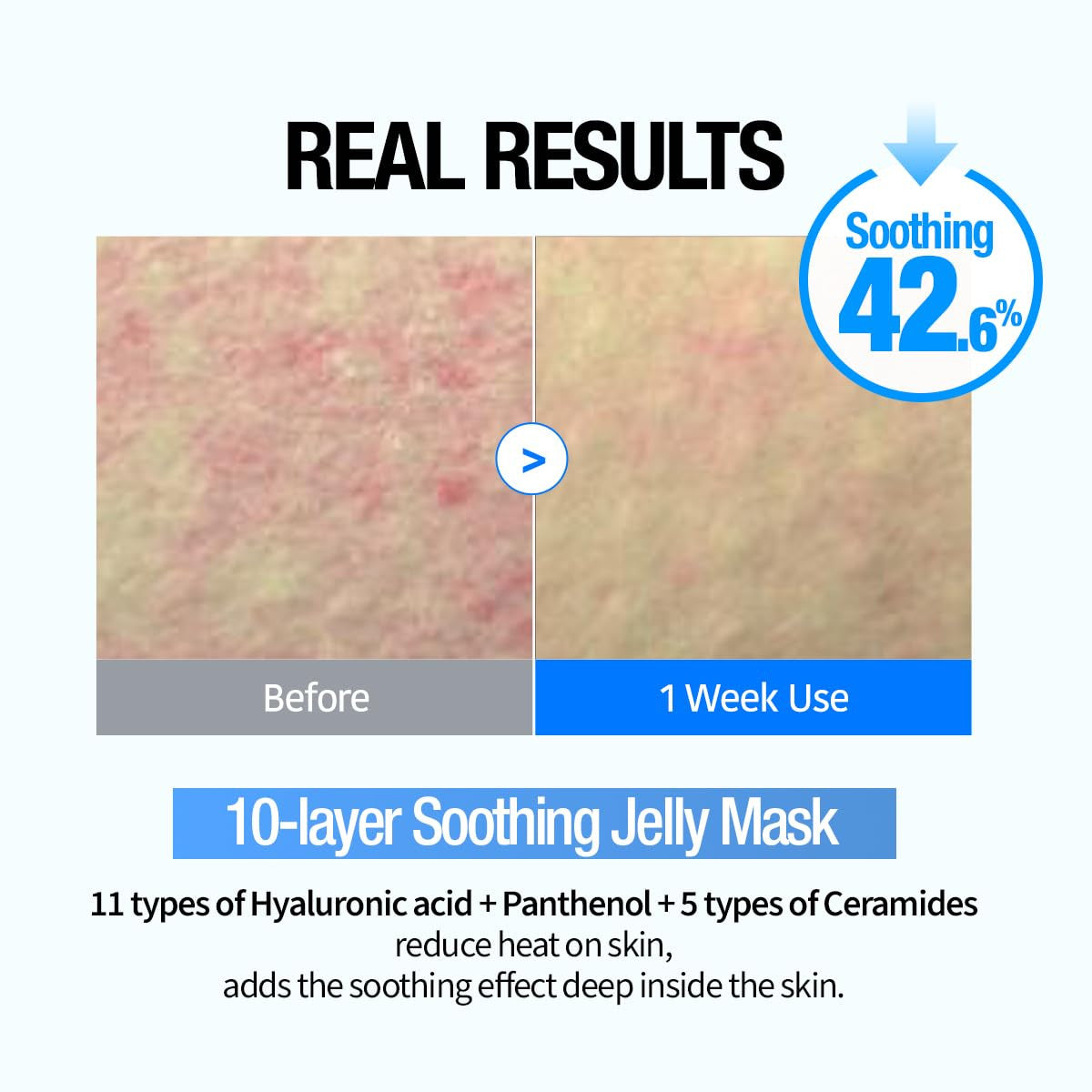 GOODAL Heartleaf Hyaluron Soothing Jelly Mask (1Sheet)