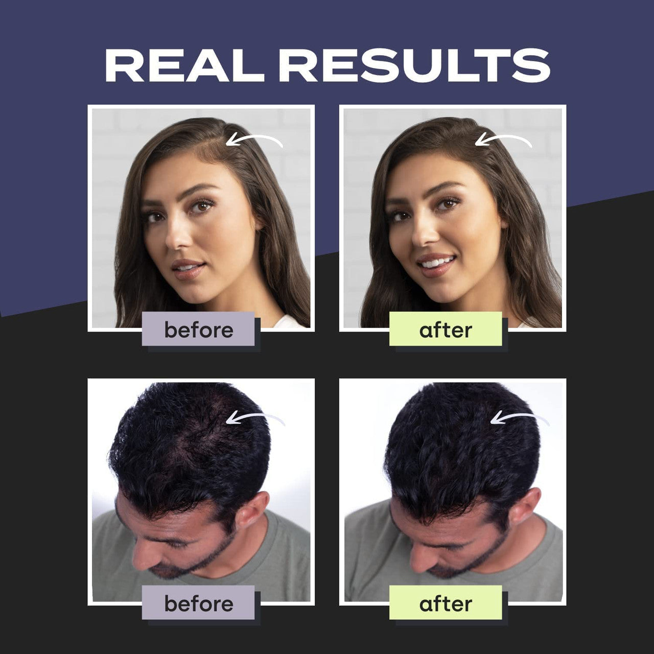 Toppik Hair Building Fiber