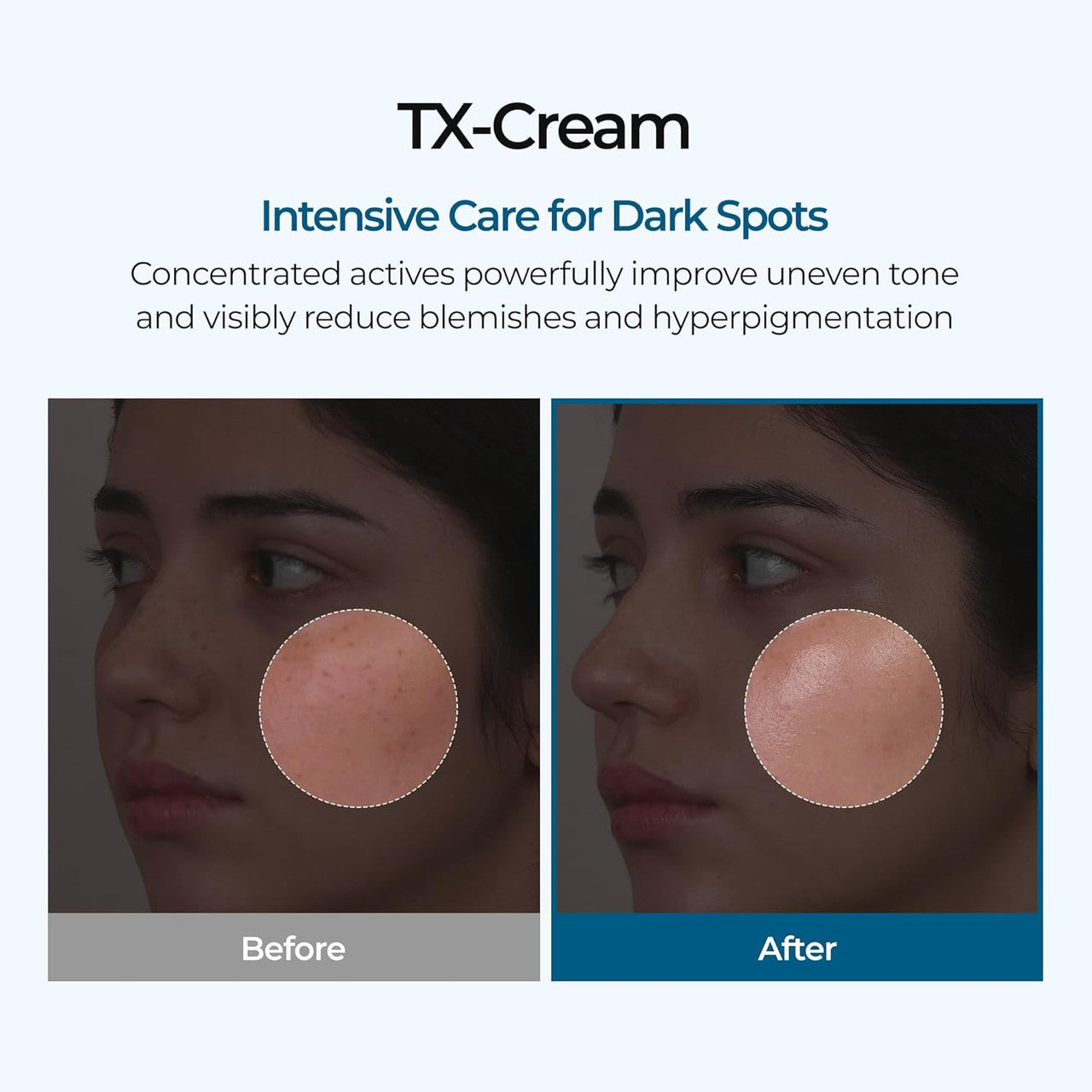 DR. MELAXIN TX Tranexamic Acid Cream (1.7oz)