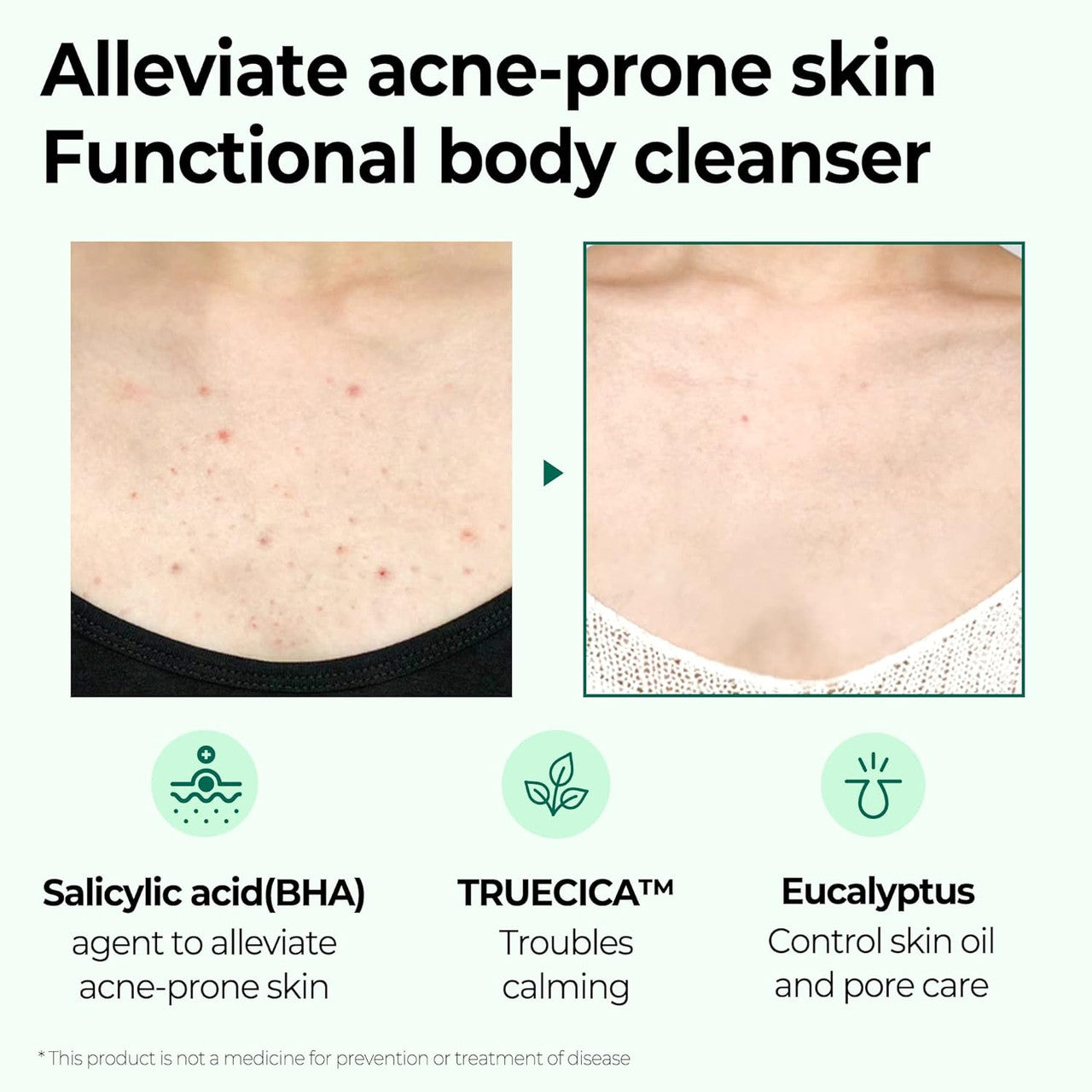 SOME BY MI AHA BHA PHA 30 Days Miracle Acne Clear Body Cleanser (13.5oz)