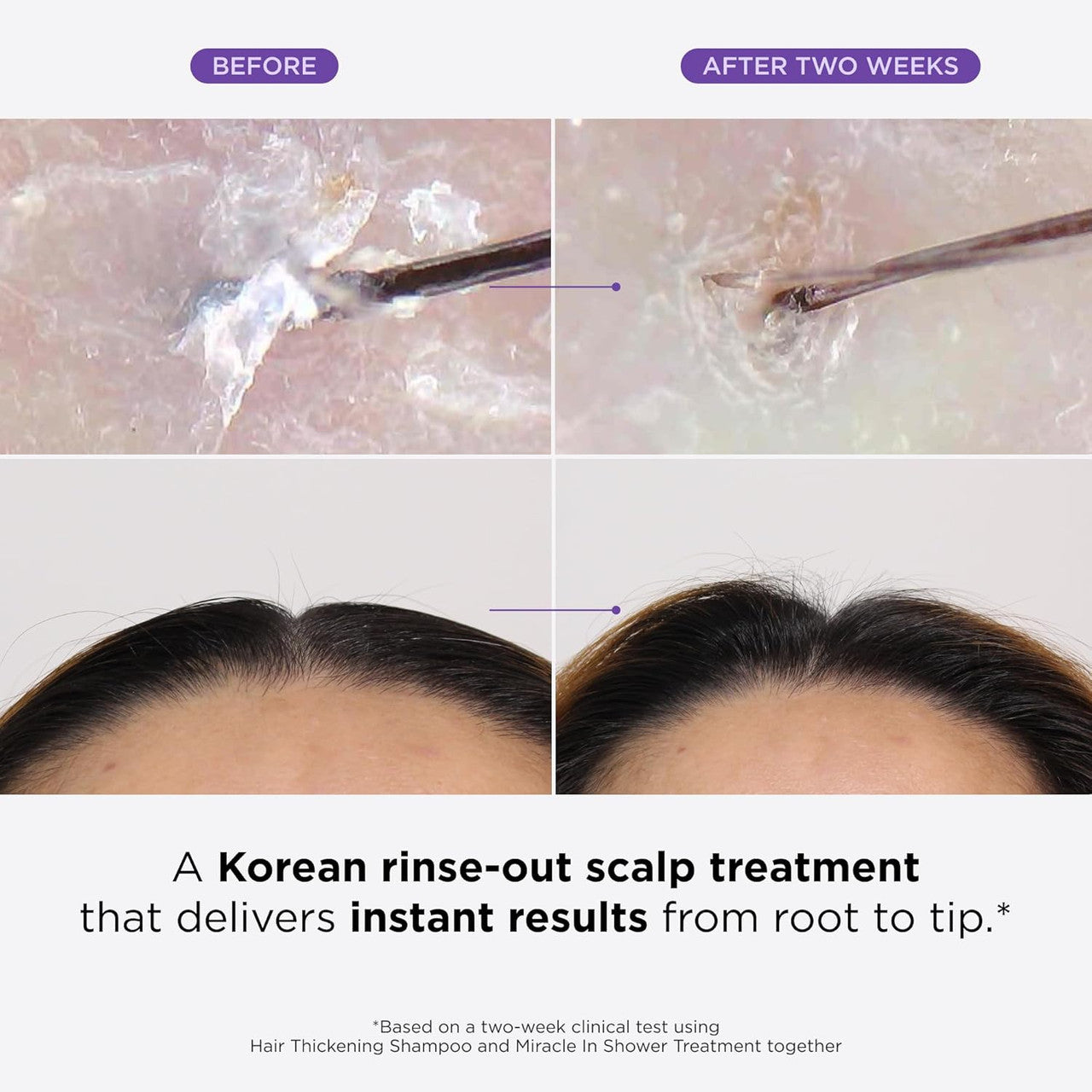 DR.GROOT Scalp Revitalizing Solution Miracle in Shower Treatment (8.4oz)