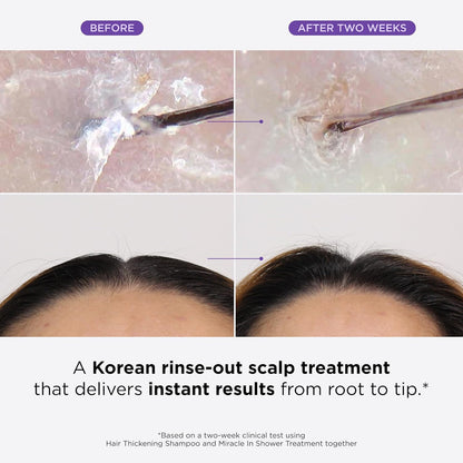 DR.GROOT Scalp Revitalizing Solution Miracle in Shower Treatment (8.4oz)