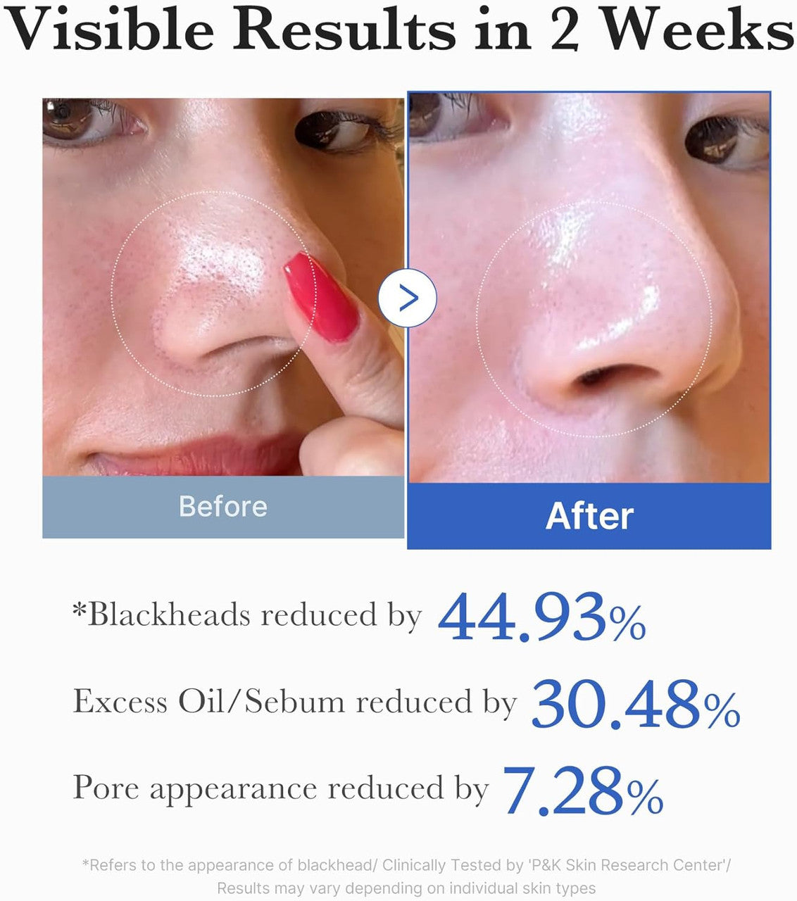 MEDICUBE  Zero Pore Pads 2.0 (70 pads)