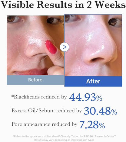 MEDICUBE  Zero Pore Pads 2.0 (70 pads)
