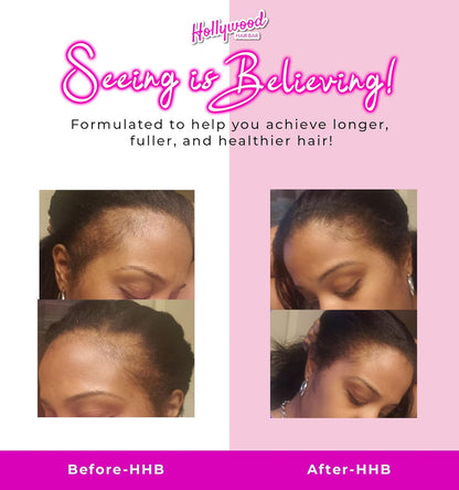 Hollywood Hair Bar Super Grow Scalp Balm (4oz)