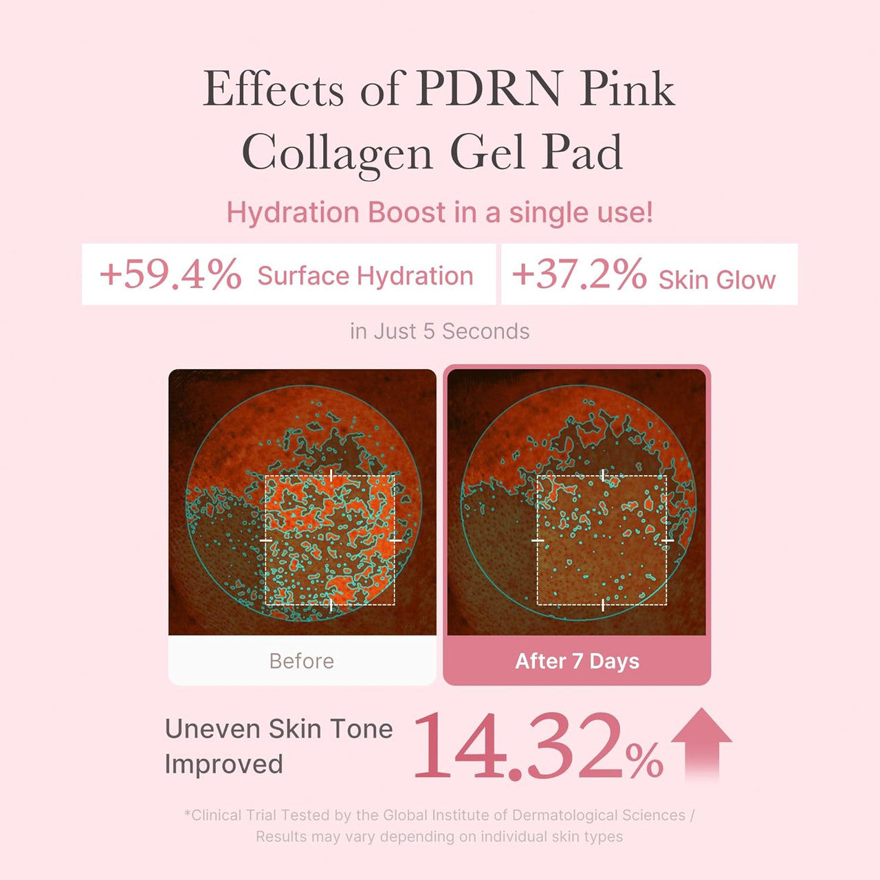 MEDICUBE PDRN Pink Collagen Toning Gel Toner Pad (70Pads)