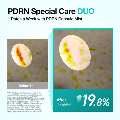 Anua PDRN Collagen Melting Patch For Glass Skin (4PCS)