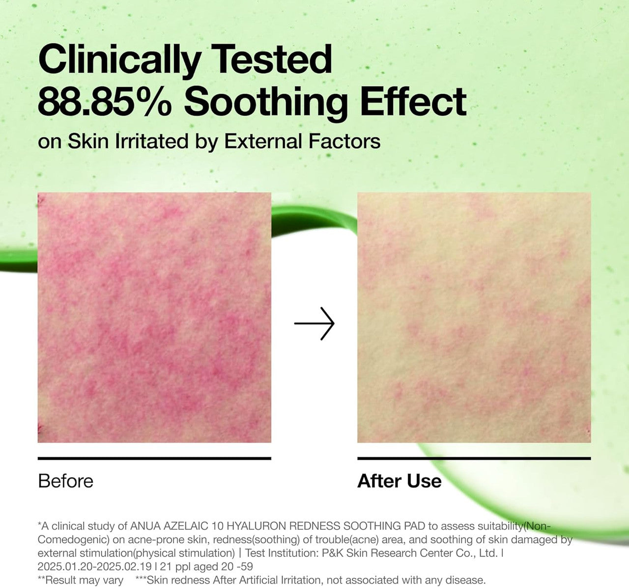 ANUA Azelaic 10 Hyaluron Redness Soothing Pad (90 Pads)