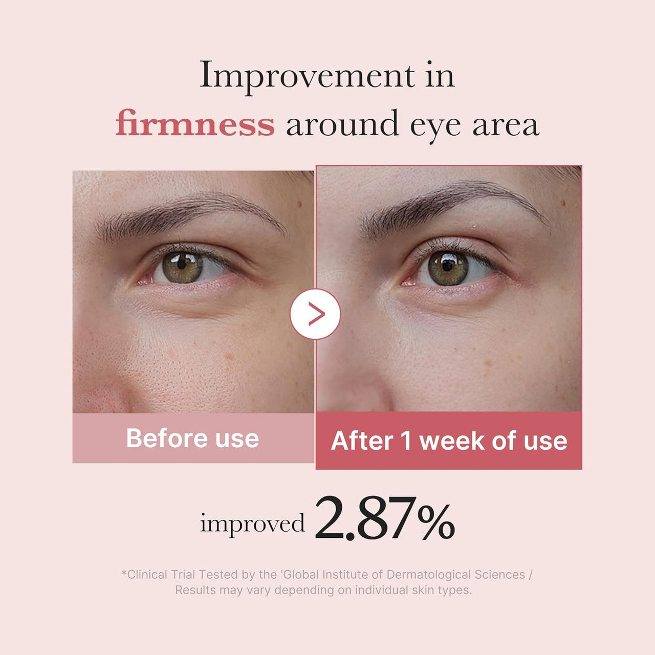 MEDICUBE PDRN Pink Peptide Eye Cream (1.01oz)