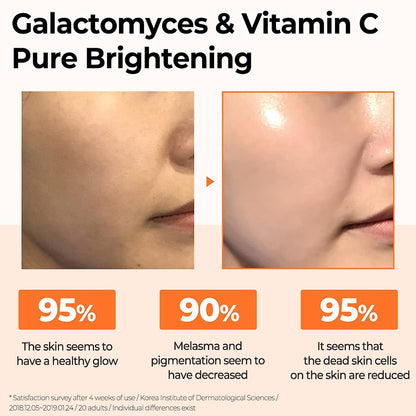 SOME BY MI Galactomyces Pure Vitamin C Glow Serum (1.01 oz)