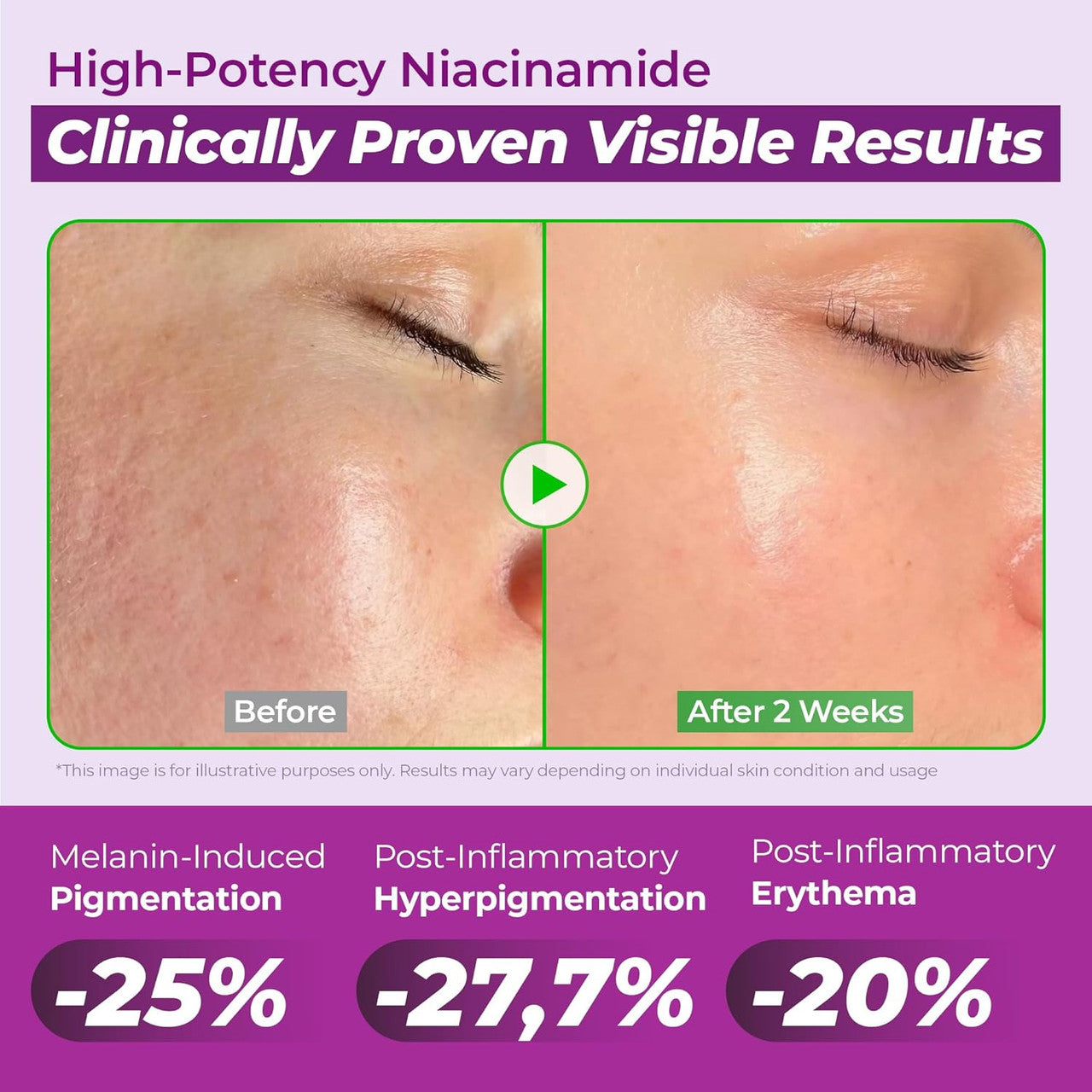 JUMISO Niacinamide 20% Face Serum (1.35oz)