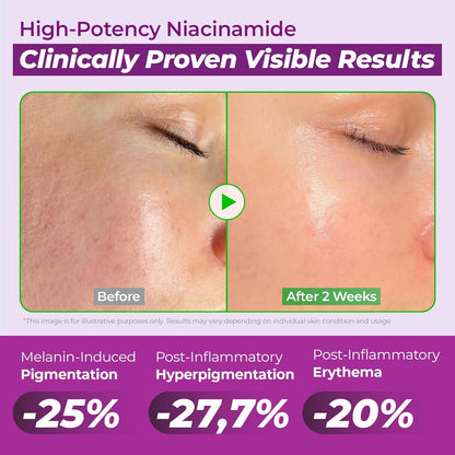 JUMISO Niacinamide 20% Face Serum (1.35oz)