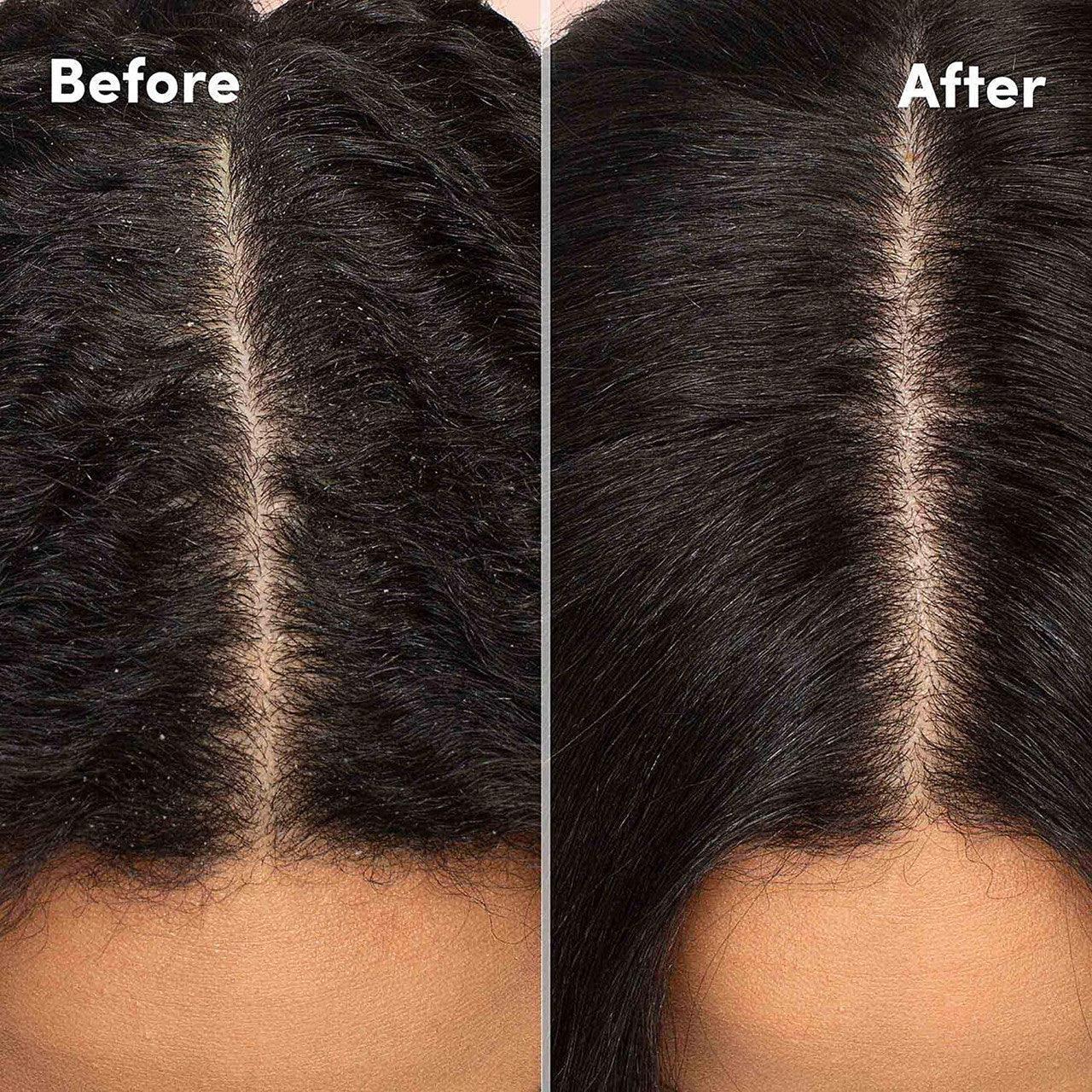MIZANI Scalp Care Dandruff Shampoo