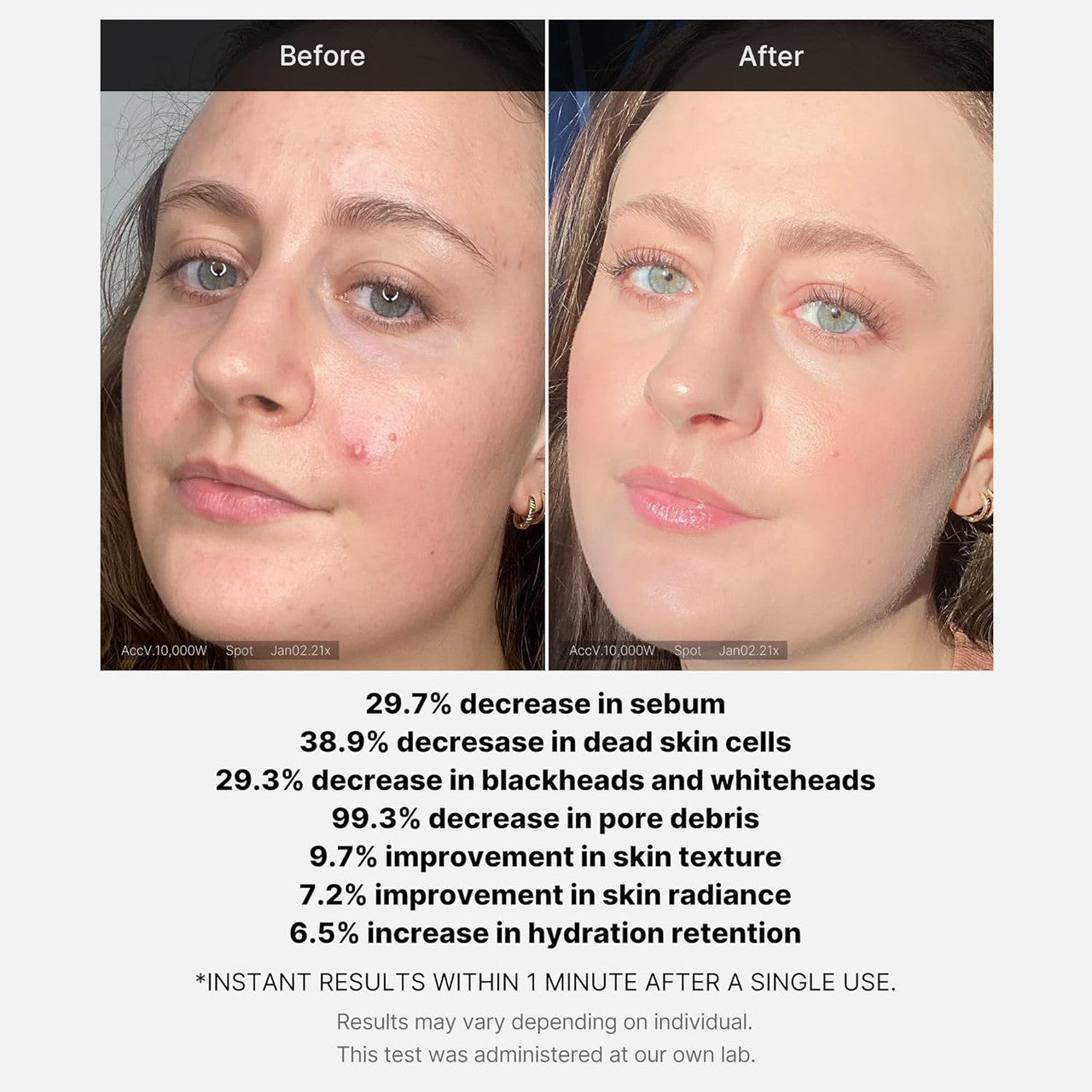 MEDICUBE 21% Red Succinic Acid Peel (1.41oz)