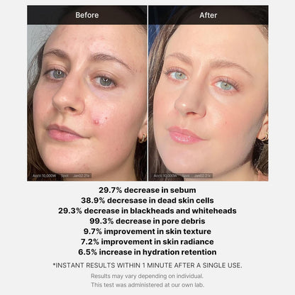 MEDICUBE 21% Red Succinic Acid Peel (1.41oz)