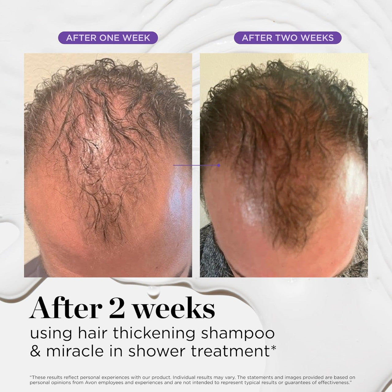 DR.GROOT Scalp Revitalizing Solution Miracle in Shower Treatment (8.4oz)