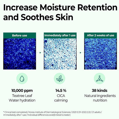 SOME BY MI AHA BHA PHA 30 Days Miracle Serum (1.69 oz)