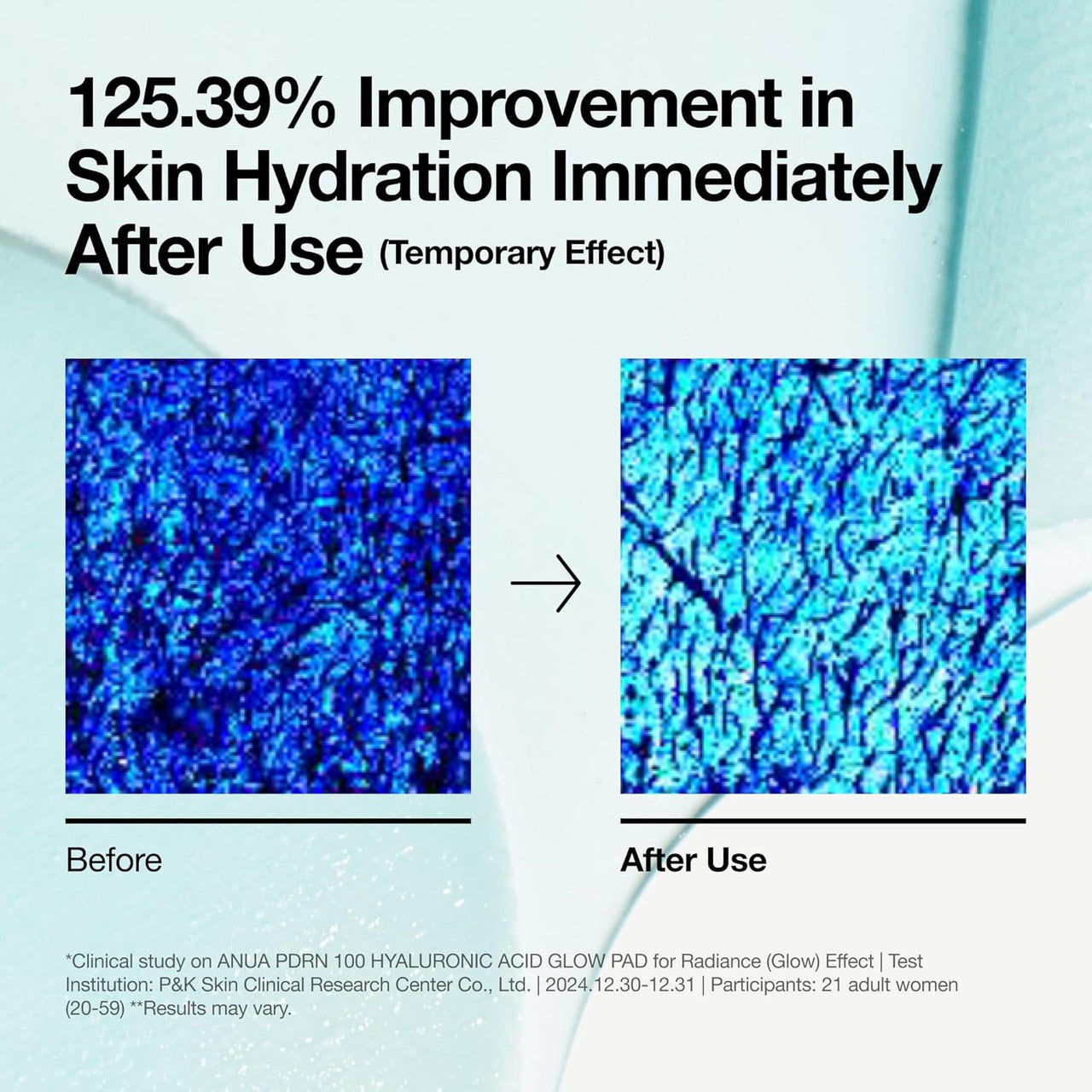 Anua PDRN 100 Hyaluronic Acid Pad  (180ml, 60 Pads)