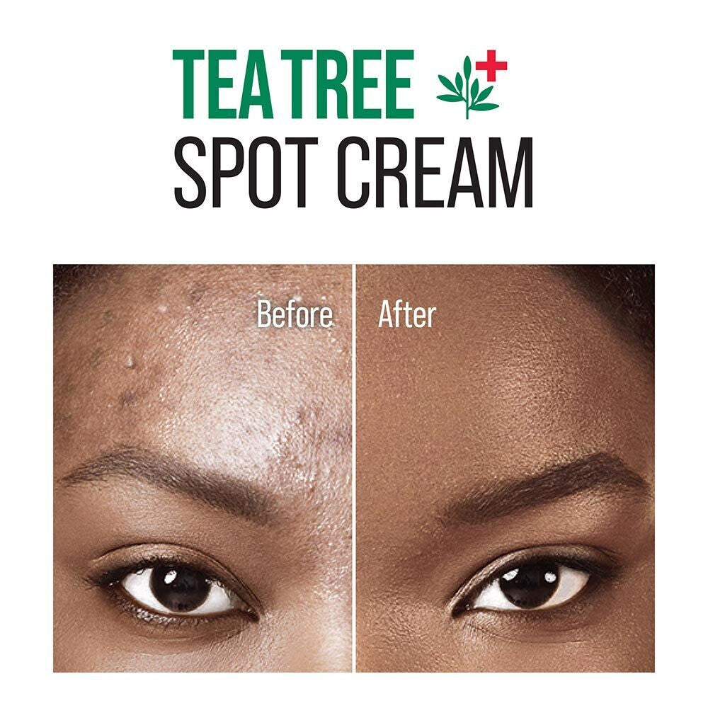 KISS Tea Tree Acne Treatment (0.94 oz)