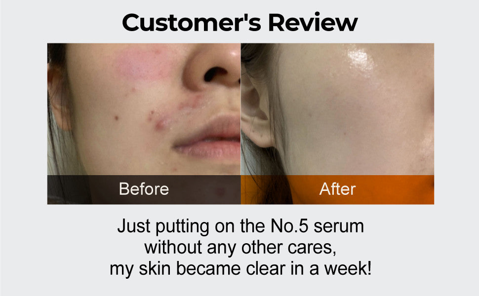 NUMBUZIN No.5 Goodbye Blemish Serum (1.69 oz)