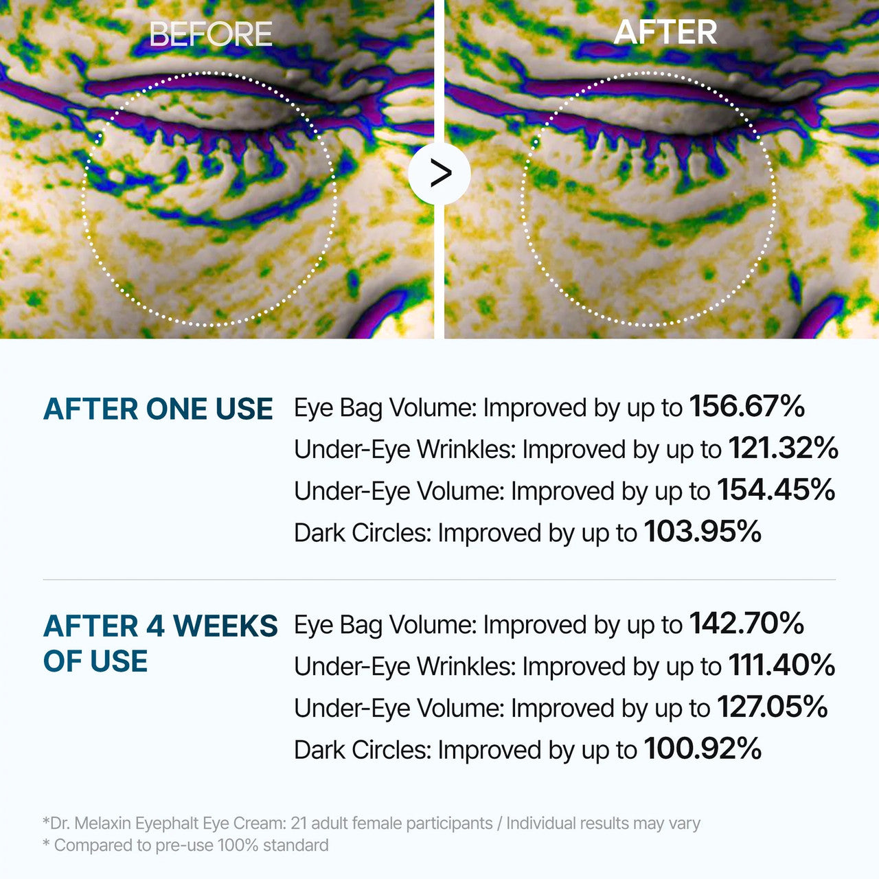 DR. MELAXIN Eyephalt Eyebag Cream (10ml)
