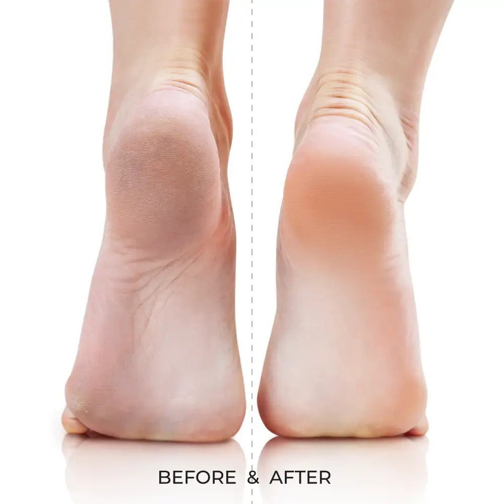 KISS Dual-Sided Quickbuff Foot File