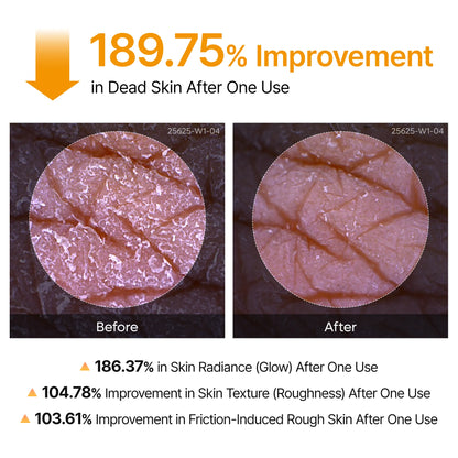 Dr.Melaxin Peel Shot Kojic Acid Turmeric Spray (6.76oz)