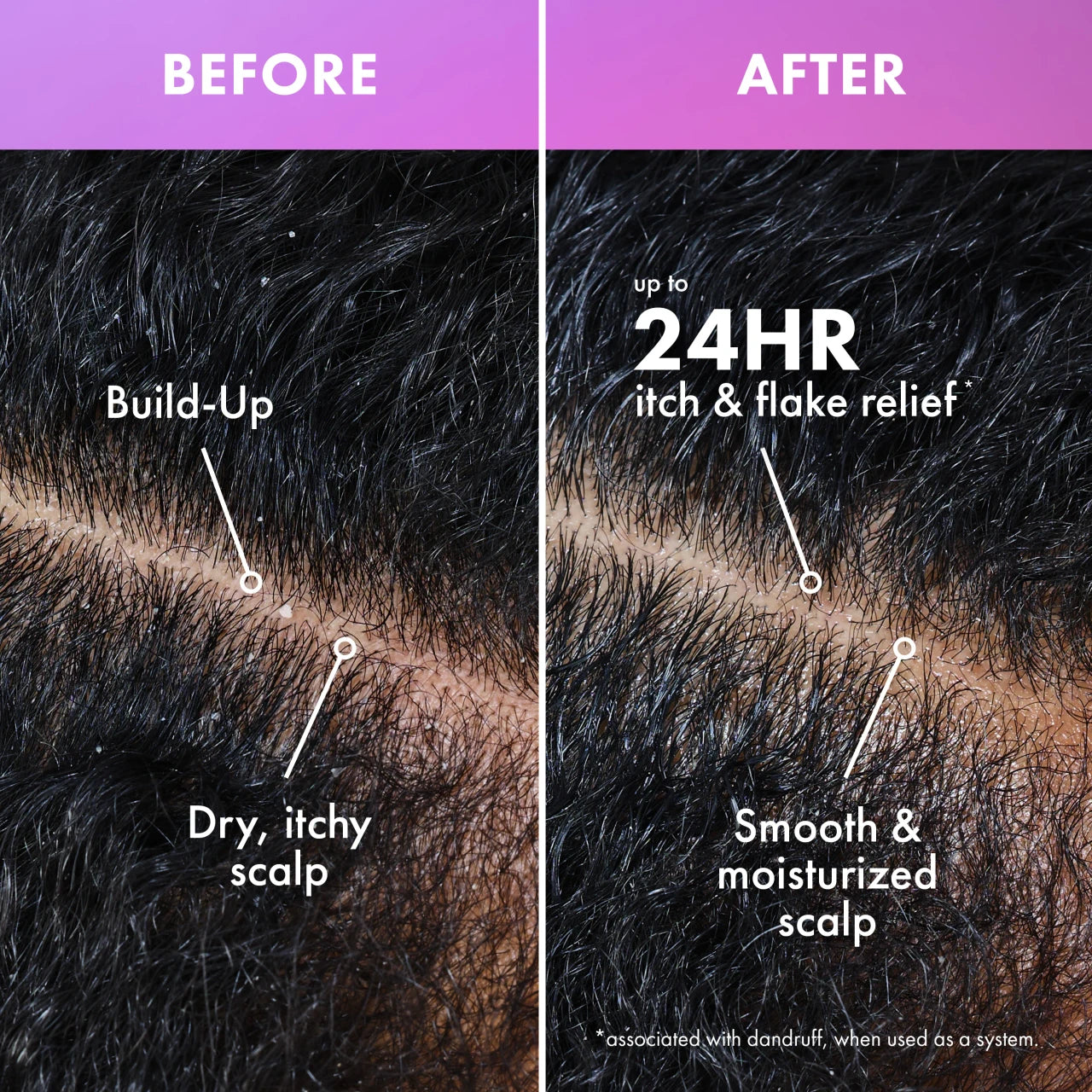 Mielle Lavender & Lychee Scalp & Hair Build Up Remover (4oz) - product image 6