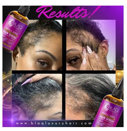 BLAQ Sage & Lychee Mega Gro Repair and Strengthen Hair Serum