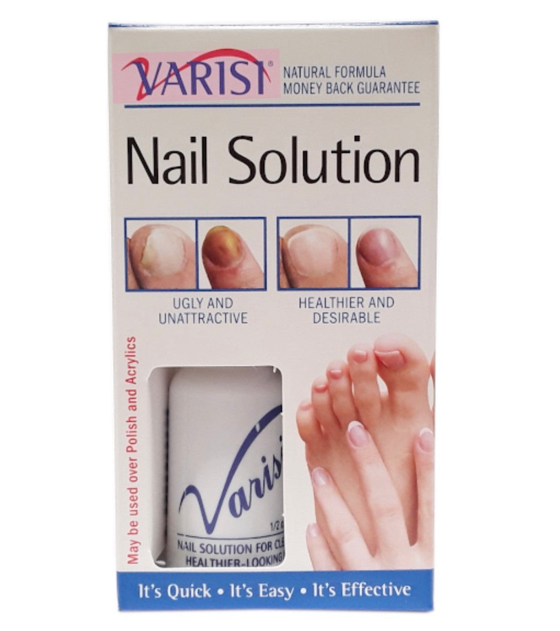 Varisi Nail Solution