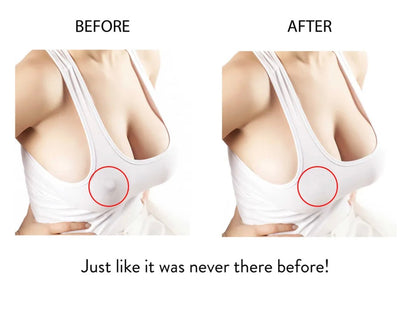 Magic Collection Nipple Patch (Reusable Silicone)