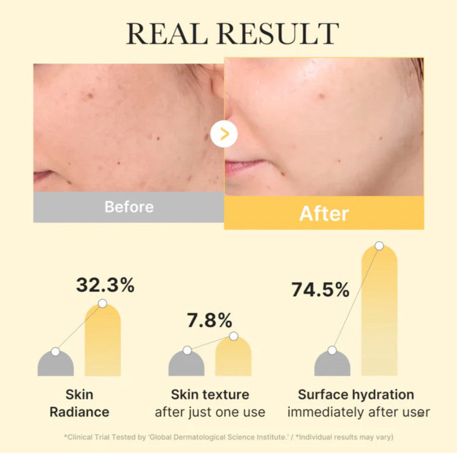 MEDICUBE Kojic Acid Turmeric Gold Jelly Gel Mask (1 Sheet)
