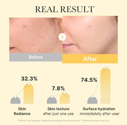 MEDICUBE Kojic Acid Turmeric Gold Jelly Gel Mask (1 Sheet)