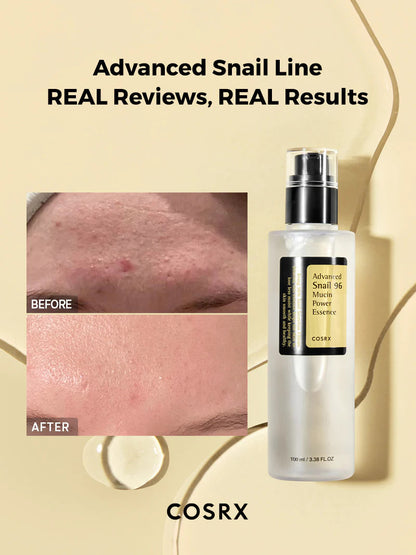 COSRX Advanced Snail 96 Mucin Power Essence (3.38 oz)