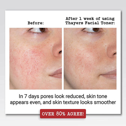 THAYERS Alcohol-Free Witch Hazel Facial Toner (12oz)