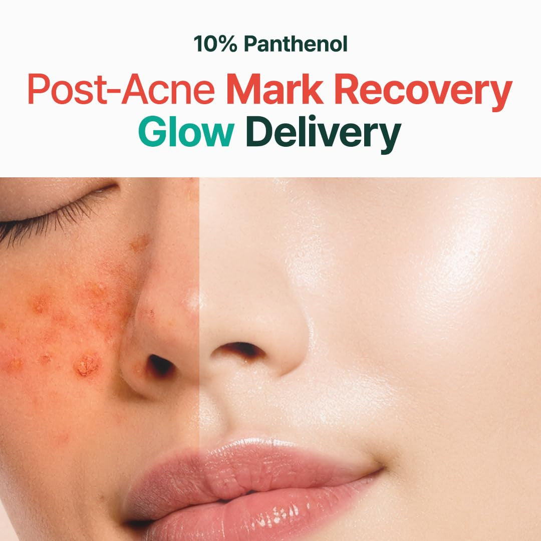 PURITO Mighty Bamboo Panthenol 10% Post-Acne Cream (3.38oz) - product image 3