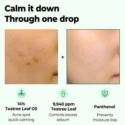 SOME BY MI 30 Days Miracle Tea Tree Clear Spot Oil (.33 oz)