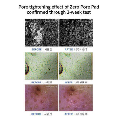 MEDICUBE Zero Pore Pads Mild (70 pads)