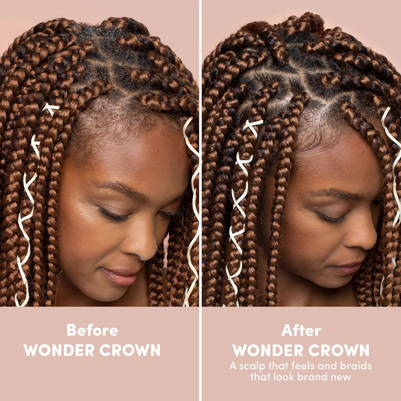 MIZANI Wonder Crown Scalp Clarifying Foaming Pre-Cleanse